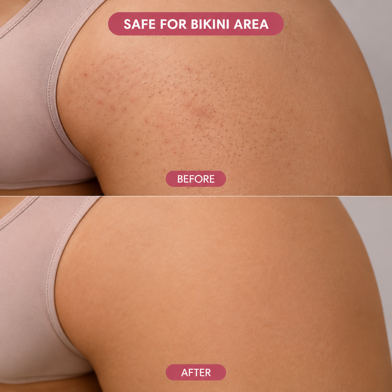 Sevori™ IPX7 2-in-1 Bikini Trimmer
